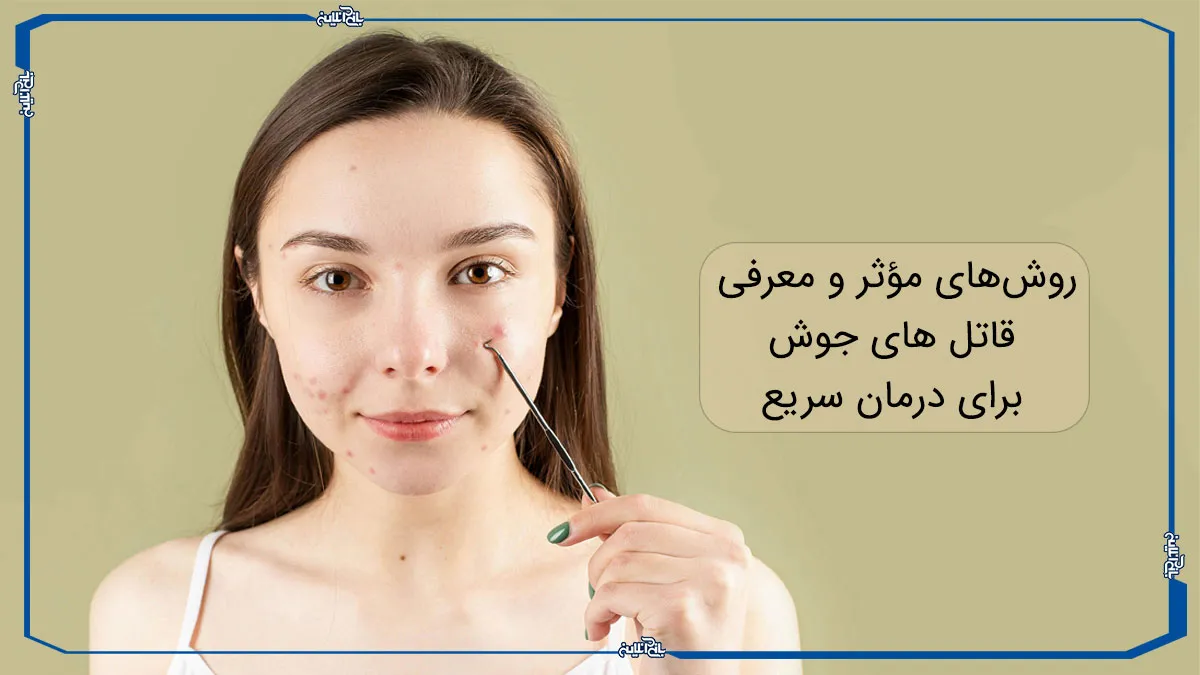روش‌های مؤثر و معرفی قاتل‌ های جوش برای درمان سریع